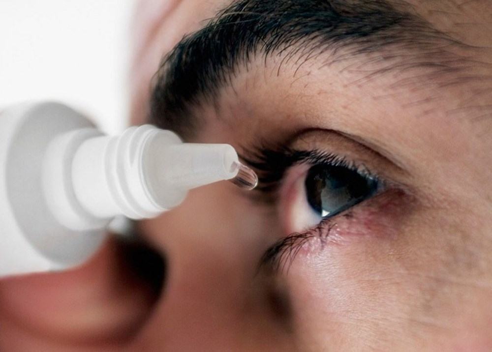 Để rửa đau mắt đỏ đúng cách phải làm sao?
